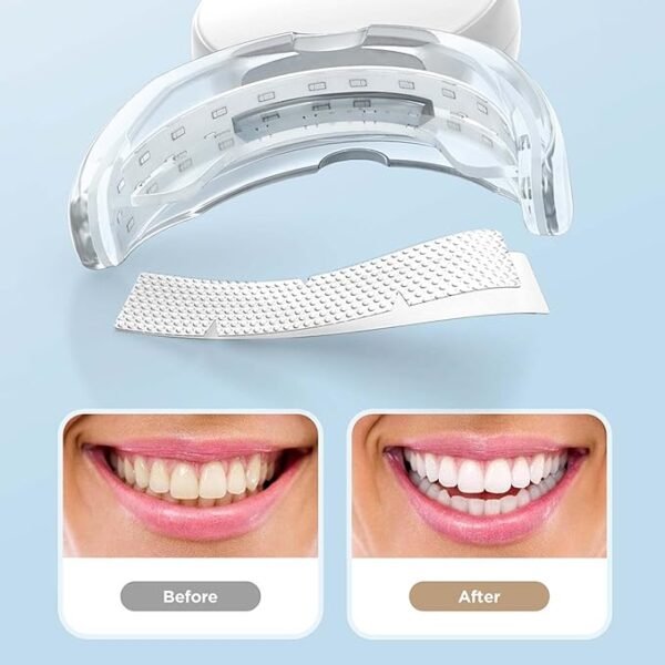 Instant Teeth Whitening Kit with 14 Pcs Strips - Image 3