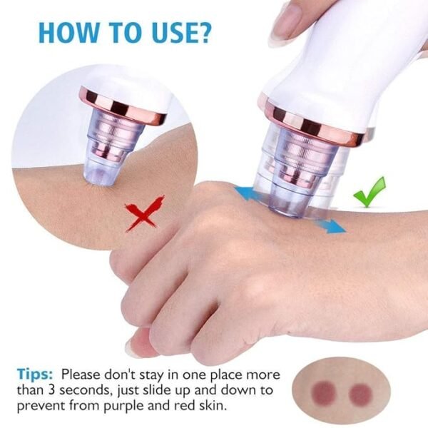 Blackhead Remover Vacuum - Image 3