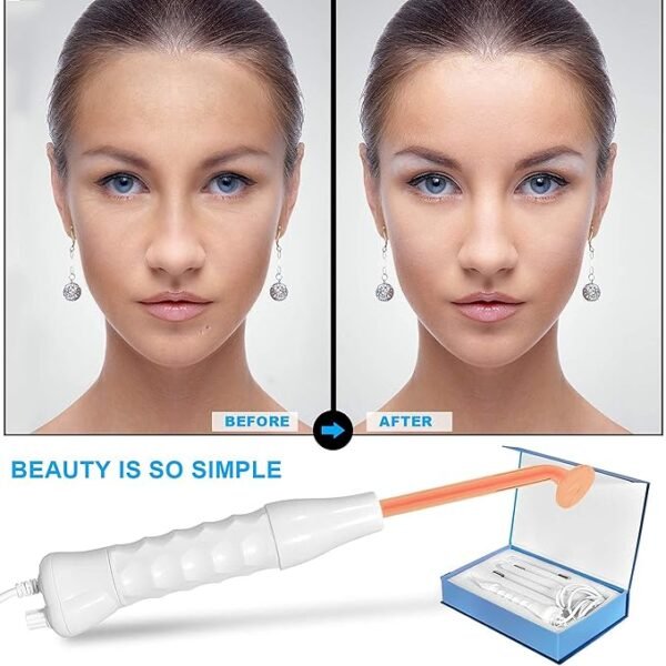 High Frequency Machine Facial Wand Acne for Skin Tightening Acne Spot Wrinkles Reducing - Image 8